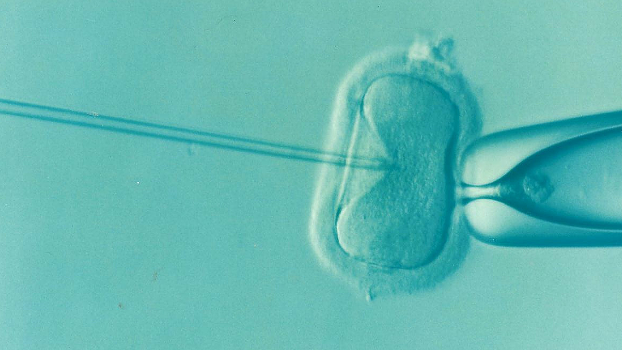 Should Insurance Cover in vitro fertilization-IVF?